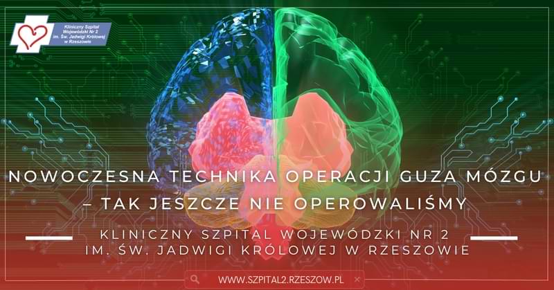 Nowoczesna technika operacji guza mózgu – tak jeszcze nie operowaliśmy